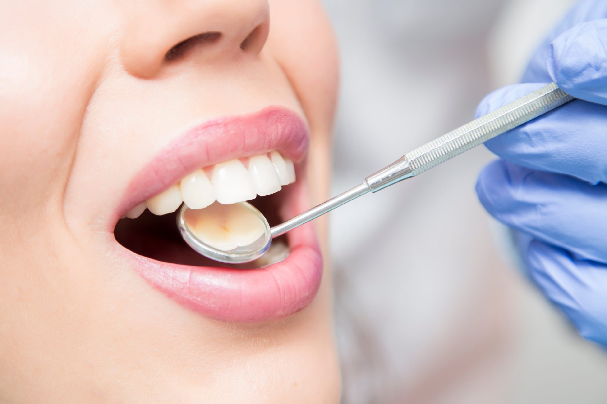 What Types of Cosmetic Dentistry Procedures Can You Choose From in Atlanta, GA?